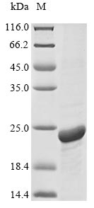 Recombinant Human Aquaporin-1(AQP1),partial