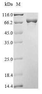 Recombinant Human Arachidonate 12-lipoxygenase, 12S-type(ALOX12)