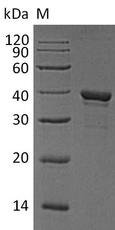 Recombinant Human Arginase-1(ARG1) (Active)
