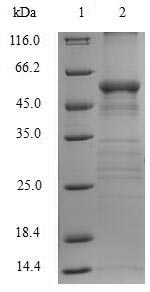 Recombinant Human Arginase-1(ARG1)