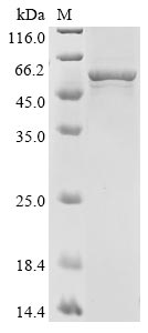 Recombinant Human Aromatase(CYP19A1)