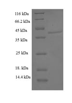 Recombinant Human Aspartyl/asparaginyl beta-hydroxylase(ASPH),partial