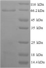 Recombinant Human Atrial natriuretic peptide receptor 1(NPR1),partial