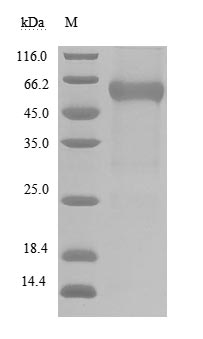 Recombinant Human B- and T-lymphocyte attenuator(BTLA),partial (Active)