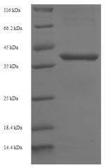 Recombinant Human B-cell lymphoma/leukemia 10(BCL10)