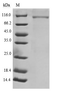 Recombinant Human B-cell receptor CD22(CD22),partial (Active)