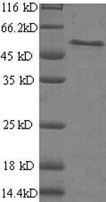 Recombinant Human B-cell receptor-associated protein 31(BCAP31),partial