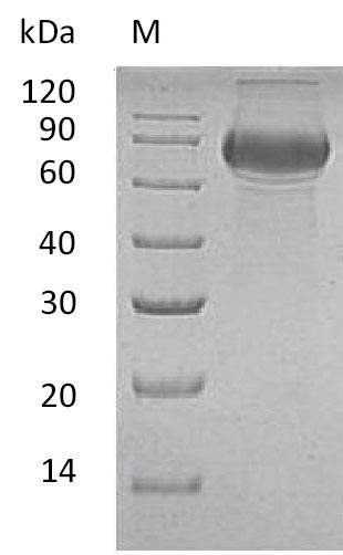 Recombinant Human B-lymphocyte antigen CD19(CD19),partial (Active)