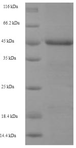 Recombinant Human Baculoviral IAP repeat-containing protein 1(NAIP) ,partial