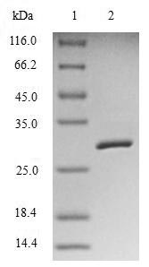 Recombinant Human Baculoviral IAP repeat-containing protein 5(BIRC5)