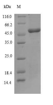 Recombinant Human Band 3 anion transport protein (SLC4A1),partial