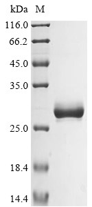 Recombinant Human Basement membrane-specific heparan sulfate proteoglycan core protein(HSPG2),partial