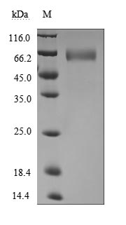 Recombinant Human Basigin(BSG),partial (Active)