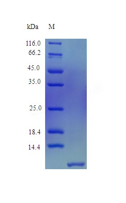 Recombinant Human Beta-defensin 4A protein(DEFB4A) (Active)