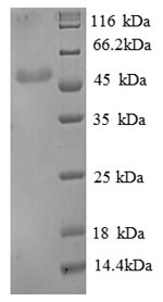 Recombinant Human Beta-enolase(ENO3) ,partial