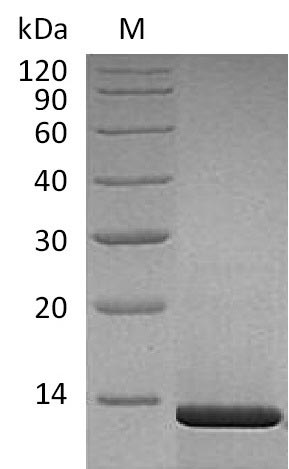 Recombinant Human Beta-nerve growth factor(NGF),partial (Active)