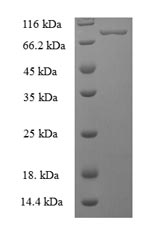 Recombinant Human Bifunctional polynucleotide phosphatase/kinase(PNKP)