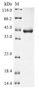 Recombinant Human Bone marrow proteoglycan(PRG2),partial