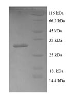 Recombinant Human Bone morphogenetic protein 4(BMP4)