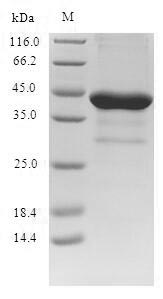 Recombinant Human Brain-derived neurotrophic factor(BDNF),partial