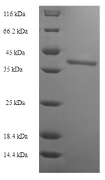 Recombinant Human Butyrophilin subfamily 2 member A2(BTN2A2),partial
