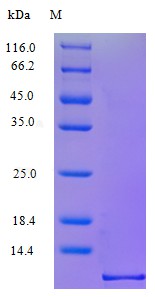 Recombinant Human C-C motif chemokine 1 protein(CCL1) (Active)