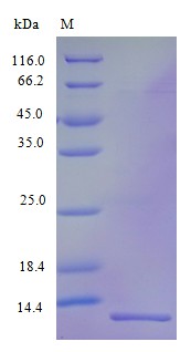 Recombinant Human C-C motif chemokine 15 protein(CCL15) (Active)