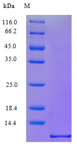 Recombinant Human C-C motif chemokine 5 protein(CCL5) (Active)