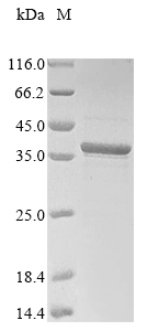 Recombinant Human C-X-C chemokine receptor type 3(CXCR3),partial