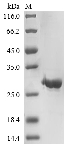 Recombinant Human C-X-C chemokine receptor type 4(CXCR4),partial