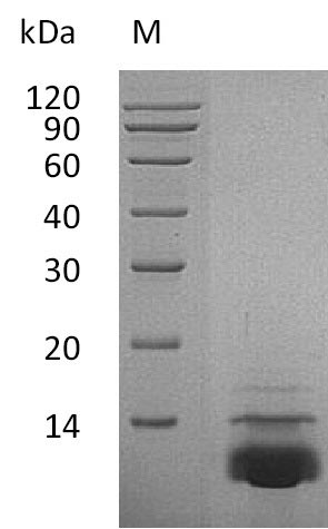 Recombinant Human C-X-C motif chemokine 5(CXCL5),partial (Active)