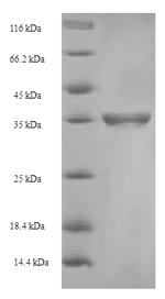 Recombinant Human C-type lectin domain family 4 member C(CLEC4C),parial (Active)