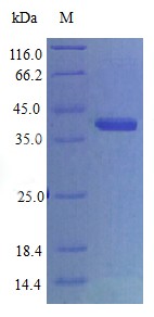 Recombinant Human CCN family member 1(CCN1)(Active)