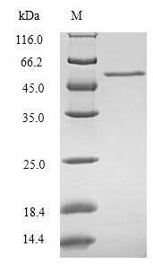 Recombinant Human CCN family member 1(CCN1)
