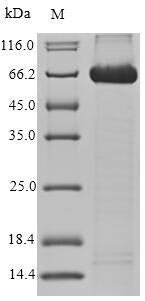 Recombinant Human CD166 antigen(ALCAM),partial
