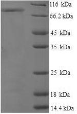 Recombinant Human CD44 antigen(CD44),partial