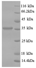 Recombinant Human CD59 glycoprotein(CD59) 