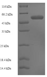 Recombinant Human CMP-N-acetylneuraminate-beta-1,4-galactoside alpha-2,3-sialyltransferase(ST3GAL3),partial