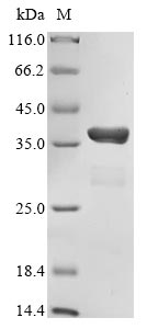 Recombinant Human CREB-binding protein(CREBBP),partial