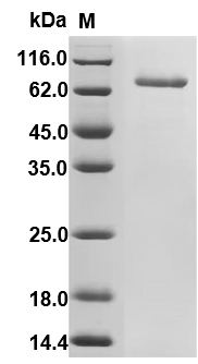 Recombinant Human Cadherin-1(CDH1),partial