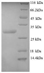 Recombinant Human Calcitonin gene-related peptide 1(CALCA),Partial