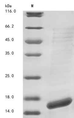 Recombinant Human Calcium-activated potassium channel subunit alpha-1(KCNMA1),partial