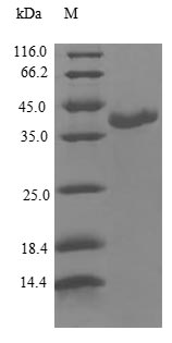 Recombinant Human Calmodulin-like protein 3(CALML3)