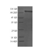 Recombinant Human Calpain-2 catalytic subunit(CAPN2)