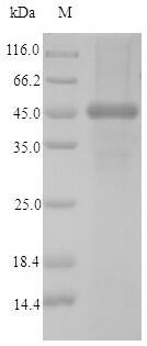 Recombinant Human Calponin-2(CNN2)