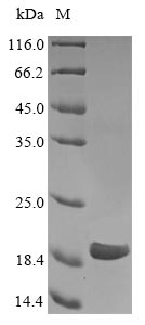 Recombinant Human Cancer/testis antigen 1(CTAG1A)