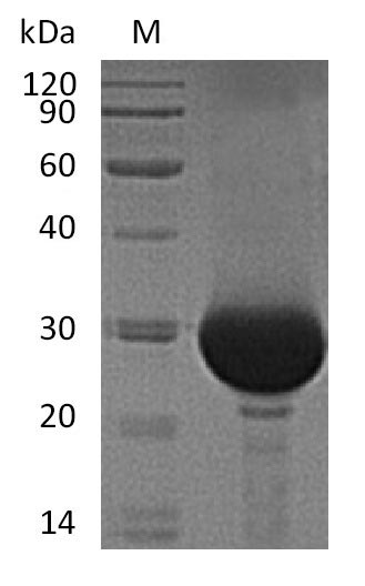 Recombinant Human Carbonic anhydrase 1(CA1) (Active)