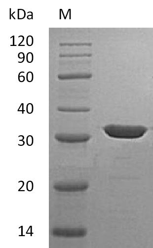 Recombinant Human Carbonic anhydrase 13(CA13) (Active)