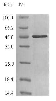 Recombinant Human Carbonic anhydrase 2(CA2)