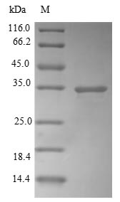 Recombinant Human Carbonyl reductase [NADPH] 1(CBR1)